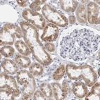 Immunohistochemical staining of human kidney shows strong cytoplasmic positivity in cells in tubules.