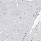 Immunohistochemical staining of human skeletal muscle shows no positivity in myocytes as expected.
