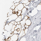 Immunohistochemical staining of human adipose tissue shows moderate cytoplasmic positivity in adipocytes.