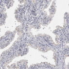 Anti-PLIN1 Antibody
