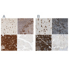 Anti-SYVN1 Antibody