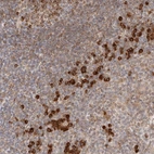 Immunohistochemical staining of human tonsil shows strong cytoplasmic positivity in non-germinal center cells.