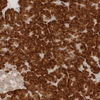 Immunohistochemical staining of human pancreas shows strong cytoplasmic positivity in exocrine glandular cells.