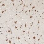 Immunohistochemical staining of human cerebral cortex shows strong cytoplasmic positivity in neurons.