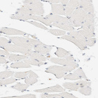 Immunohistochemical staining of human skeletal muscle shows no positivity in myocytes as expected.