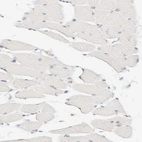 Immunohistochemical staining of human skeletal muscle shows no positivity in myocytes as expected.