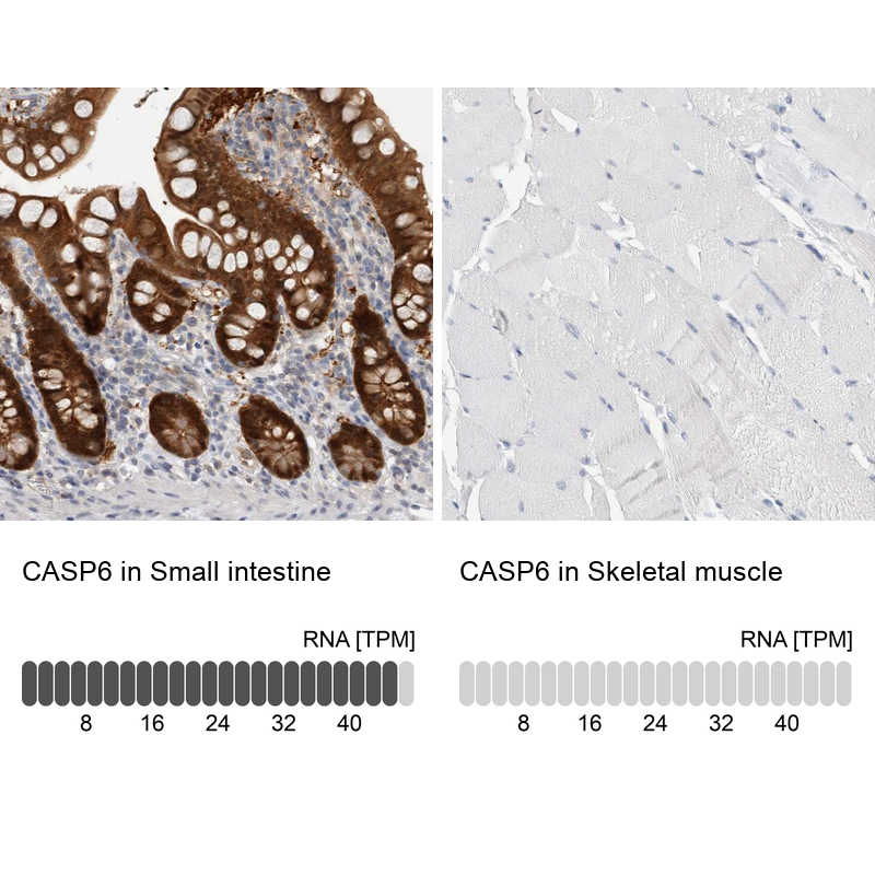 Anti-CASP6 Antibody