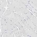Immunohistochemical staining of human skeletal muscle shows low expression as expected.