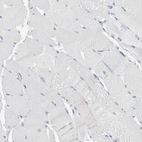 Immunohistochemical staining of human skeletal muscle shows low expression as expected.
