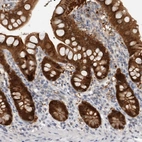 Immunohistochemical staining of human small intestine shows high expression.