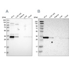 Western blot analysis using Anti-CASP6 antibody HPA024303 (A) shows similar pattern to independent antibody HPA011337 (B).