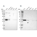Western blot analysis using Anti-CASP6 antibody HPA024303 (A) shows similar pattern to independent antibody HPA011337 (B).