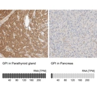 Anti-GPI Antibody