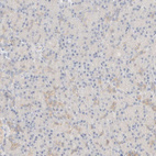 Immunohistochemical staining of human pancreas shows low positivity in exocrine glandular cells as expected.