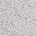 Immunohistochemical staining of human pancreas shows low positivity in exocrine glandular cells as expected.