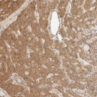 Immunohistochemical staining of human parathyroid gland shows moderate cytoplasmic positivity in chief cells.