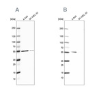 Western blot analysis using Anti-GPI antibody HPA024305 (A) shows similar pattern to independent antibody HPA052171 (B).