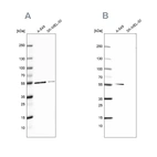 Western blot analysis using Anti-GPI antibody HPA024305 (A) shows similar pattern to independent antibody HPA052171 (B).