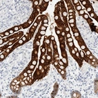 Immunohistochemical staining of colon shows strong cytoplasmic positivity in glandular cells.