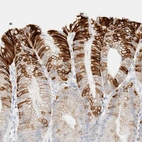 Immunohistochemical staining of human stomach shows moderate to strong cytoplasmic positivity in glandular cells.