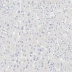 Immunohistochemical staining of human liver shows no positivity in hepatocytes as expected.