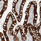 Immunohistochemical staining of human small intestine shows strong cytoplasmic positivity in glandular cells.