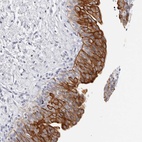 Anti-RPH3AL Antibody