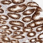 Anti-FAM129B Antibody