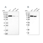 Western blot analysis using Anti-FAM129B antibody HPA024312 (A) shows similar pattern to independent antibody HPA021417 (B).