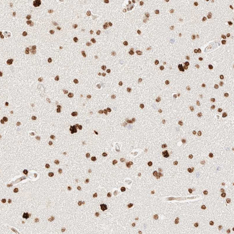 Anti-ZSCAN18 Antibody