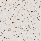 Anti-ZSCAN18 Antibody