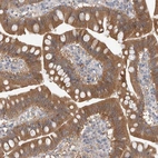 Anti-HTATIP2 Antibody