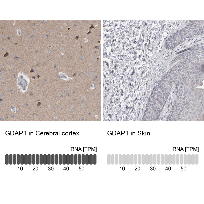 Anti-GDAP1 Antibody