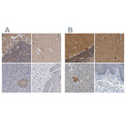 Immunohistochemical staining of human cerebellum, cerebral cortex, pancreas and skin using Anti-GDAP1 antibody HPA024334 (A) shows similar protein distribution across tissues to independent antibody HPA014266 (B).