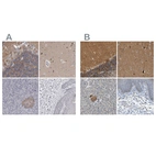 Immunohistochemical staining of human cerebellum, cerebral cortex, pancreas and skin using Anti-GDAP1 antibody HPA024334 (A) shows similar protein distribution across tissues to independent antibody HPA014266 (B).