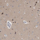 Immunohistochemical staining of human cerebral cortex shows moderate cytoplasmic positivity in neurons.