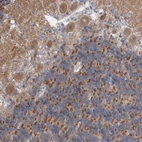 Immunohistochemical staining of human cerebellum shows moderate cytoplasmic positivity in Purkinje cells.
