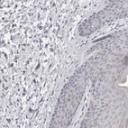 Immunohistochemical staining of human skin shows negative cytoplasmic positivity in squamous epithelial cells as expected.