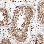 Immunohistochemical staining of human testis shows moderate positivity in nuclear membrane in cells in seminiferous ducts.