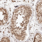Immunohistochemical staining of human testis shows moderate positivity in nuclear membrane in cells in seminiferous ducts.