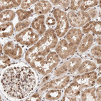 Immunohistochemical staining of human kidney shows moderate positivity in nuclear membrane in cells in tubules.