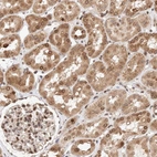 Immunohistochemical staining of human kidney shows moderate positivity in nuclear membrane in cells in tubules.