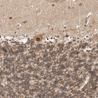 Immunohistochemical staining of human cerebellum shows strong positivity in nuclear membrane in Purkinje cells.