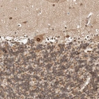 Immunohistochemical staining of human cerebellum shows strong positivity in nuclear membrane in Purkinje cells.
