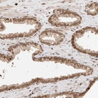 Immunohistochemical staining of human prostate shows strong positivity in nuclear membrane in glandular cells.