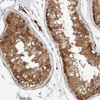 Immunohistochemical staining of human testis shows moderate granular cytoplasmic positivity in cells in seminiferous ducts.