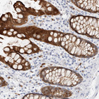 Immunohistochemical staining of human rectum shows strong cytoplasmic positivity in glandular cells.