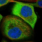 Immunofluorescent staining of human cell line A-431 shows localization to cytosol.