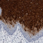 Immunohistochemical staining of human esophagus shows high expression.