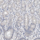 Immunohistochemical staining of human stomach shows low expression as expected.